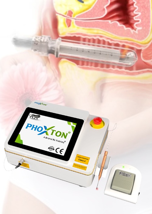 Laser Machine for Cosmetic Gynecology Treatement