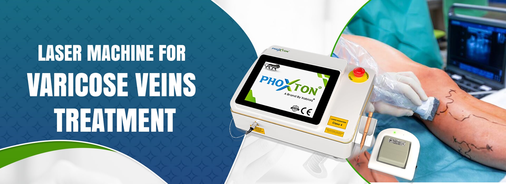 Laser Machine for Varicose Veins Treatment in Ahmedabad